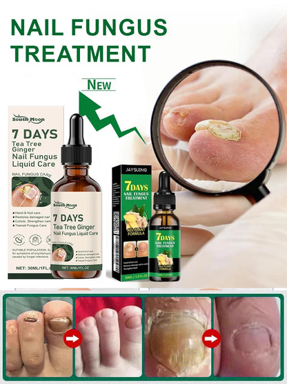 Tea Tree & Ginger Nail Fungus Care Serum – Advanced Nail Repair Formula