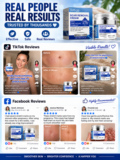 💎 Advanced Scar Repair Cream ✨ Restore Smooth-Looking Skin | Face & Body Silicone Scar Treatment Care for Visible Scar Improvement
